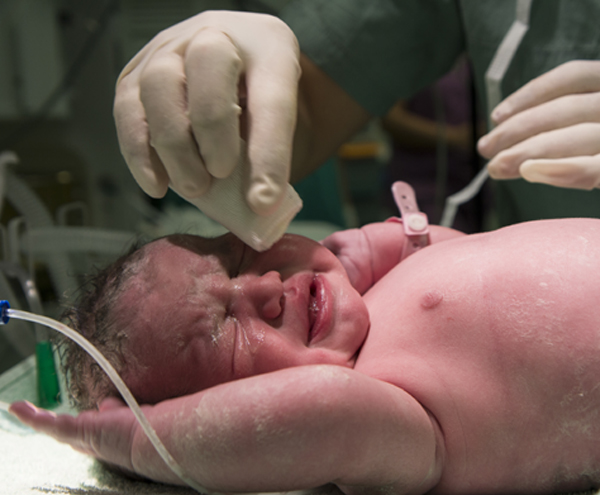 Normal Vaginal Delivery