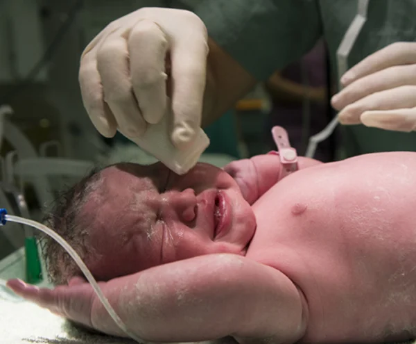 Normal Vaginal Delivery