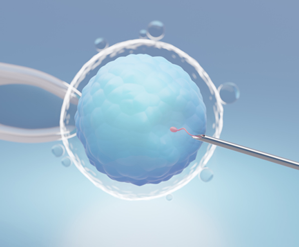 IVF