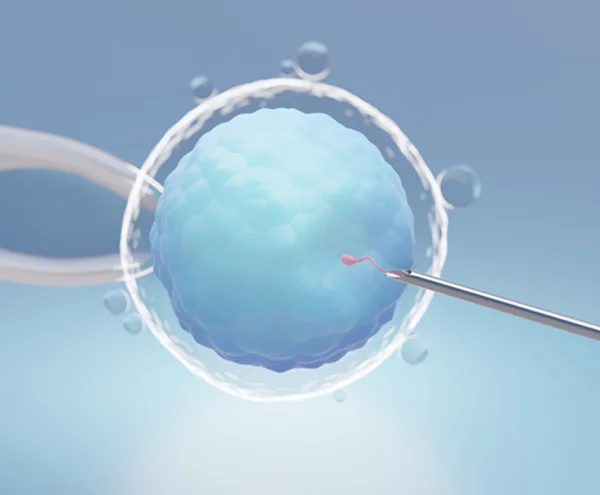 IVF